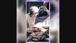 فیلم کامل زایمان سزارین