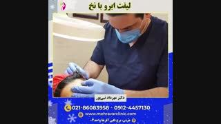لیفت صورت با نخ