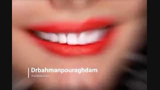 بهترین روکش سرامیکی دندان (دکتر یلدا بازرگان)02122220000