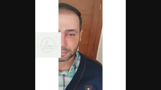 فقط ۱۰ روز بعد از جراحی بینی