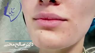 جراحی کیست برانکیال تیپ یک