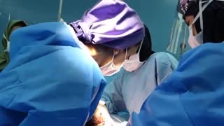 عمل زایمان سزارین