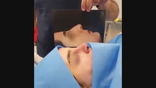 فیلم واقعی جراحی زیبایی بینی و انحراف