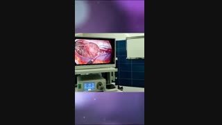 جراحی فتق دو طرفه کشاله ران به روش لاپاراسکوپی