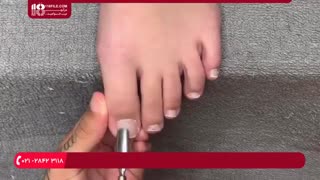 آموزش پدیکور ناخن های آسیب دیده پا