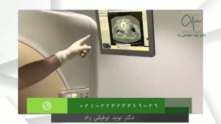 تزریق اپیدورال