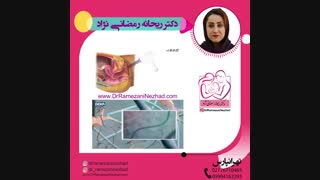 بهترین روش جوان سازی واژن