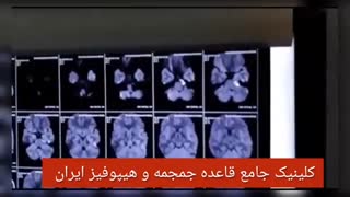 نورالژی تری ژمینال