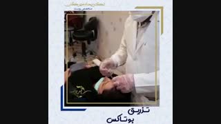 تزریق بوتاکس درمان جای جوش