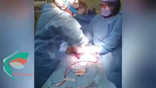 سزارین به علت سابقه میومکتومى