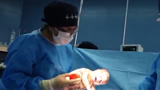 فیلم عمل زایمان سزارین