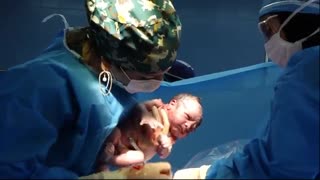 فیلم عمل زایمان سزارین