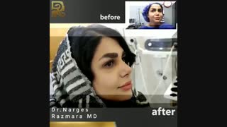 عمل زیبایی بینی
