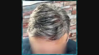 پروتز مو طبیعی جنس عالی 09198858620