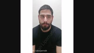 نتیجه اصلاح برجستگی گوش |  الوجراح