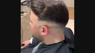 پروتز مو فیلم  09198858620