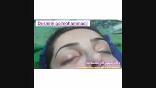 جراحی زیبایی بینی
