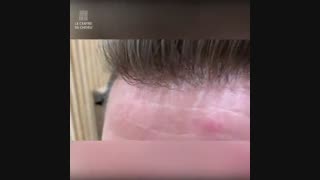 انواع پروتز مو جدید 09198858620