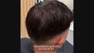 پروتز مو تکه ای  09198858620