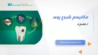 تاثیر مواد قندی بر دندان ها | دکتر لیلا عطایی