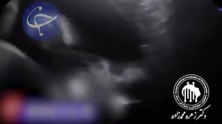 نوزادى که با پدر مادرش دست تکان میدهد