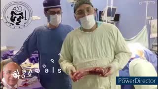 با عمل جراحی اسلیو معده پذیرش و حجم غذا بسیار کم میشود