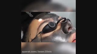 کربن تراپی در کلینیک تخصصی جوُان