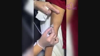 روشن کردن پوست دست با کربوکسی تراپی