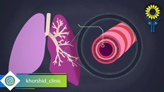 آسم چگونه عمل میکند؟