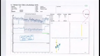 توانبخشی سرگیجه