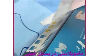 عمل کوچک کردن سینههای بسیار بزرگ