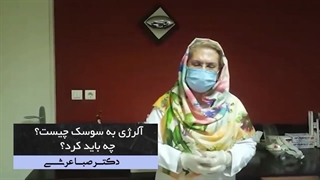 آلرژی به سوسک