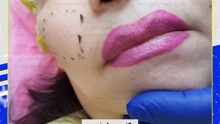 مادلینگ گونه