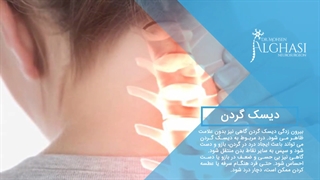 دیسک گردن