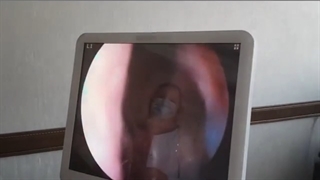 فیلم کنترل سینوس