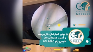 فیلم بدون سانسور جراحی بازسازی رباط صلیبی زانو