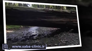 آیا علائم آلرژی بهاره شما شروع شده؟