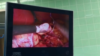 فیلم واقعی عمل جراحی چاقی