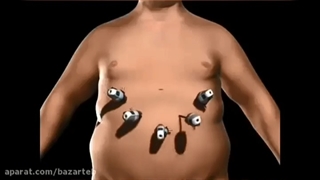 فیلمی جالب درباره اسلیو معده