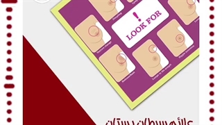 علائم سرطان پستان