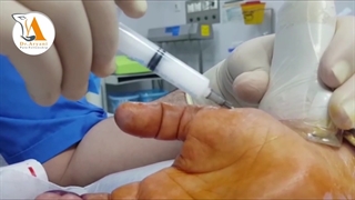 جراحی نکنید