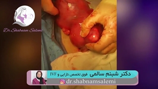 عمل میومکتومی