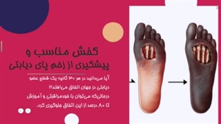 پیشگیری از زخم پای دیابتی با کفش مناسب