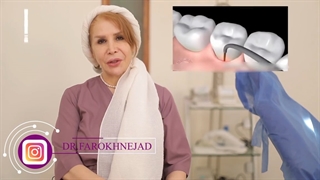 کاربرد لیزرتراپی در دندانپزشکی