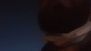 امین ترمیم سوختگی