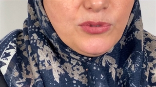 بهترین لمینت سرامیکی و ایمپلنت (دکتر یلدا بازرگان)02122220000