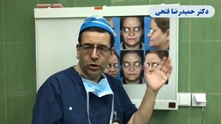 لیفت آندوسکوپی صورت