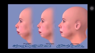 درمان ارتودنسی و جراحی فک / متخصص ارتودنسی / دکتر جمیلیان