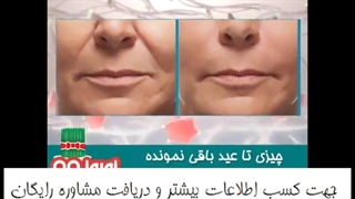 تخفیف ویژه کرم ضد چروک صمیم 09120852440 آر اف فرکشنال