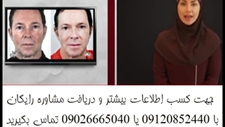 قیمت کرم ضد لک صمیم 09120852440 تزریق ژل